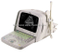 Digital ultrasound imaging system