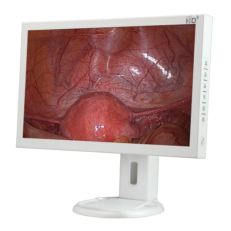 HD 21.5&quot; Endoscopy Surgical Monitor
