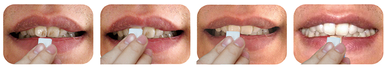 how--to-use-magic-teeth-cleaning-strips-sponge cómo - usar-magia-dientes-limpieza-tiras-esponja