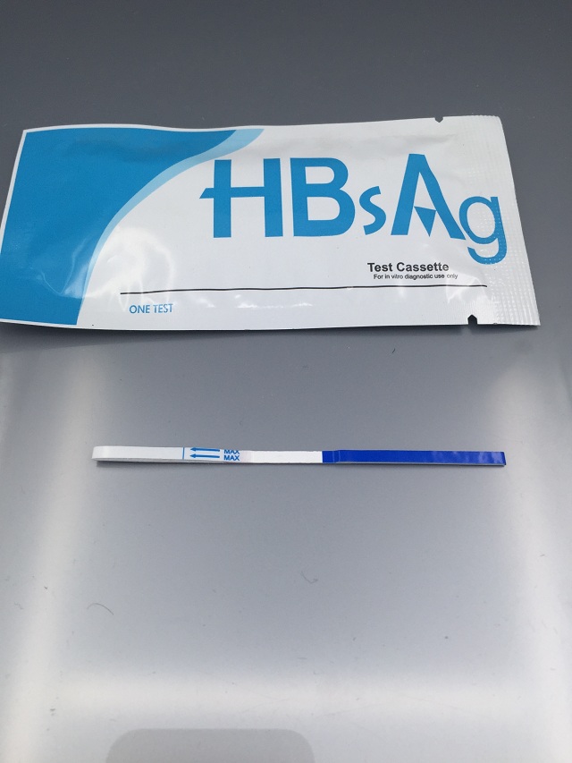 HBsAg Rapid Test