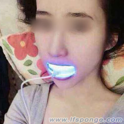 Cold-light-whitening-Applying-the-bleach-agent-with-high-concentration-to-the-discolored-teeth--from-lfsponge.com Blanqueamiento de luz-Aplicación-el- agente de blanqueo-con-concentración- alta-de-los-discolorados-teeth--de-lfsponge.com