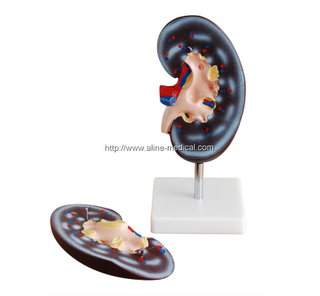 Kidney Model (2 parts)