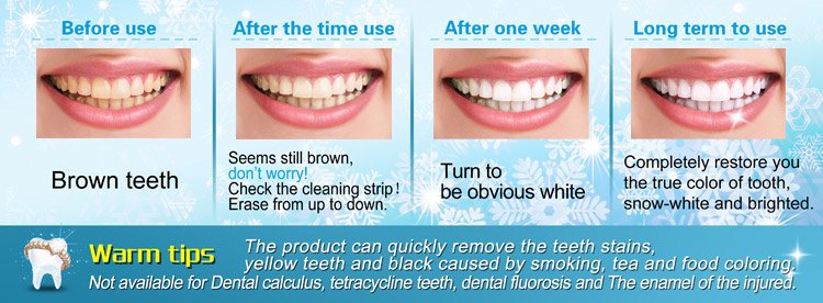 teeth cleaning kit professional dental cleaning.jpg Kit de limpieza dental profesional dental cleaning.jpg
