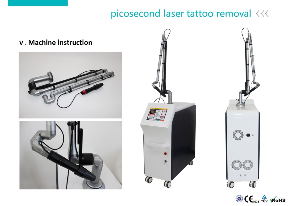 máquina de extracción de tatuajes 