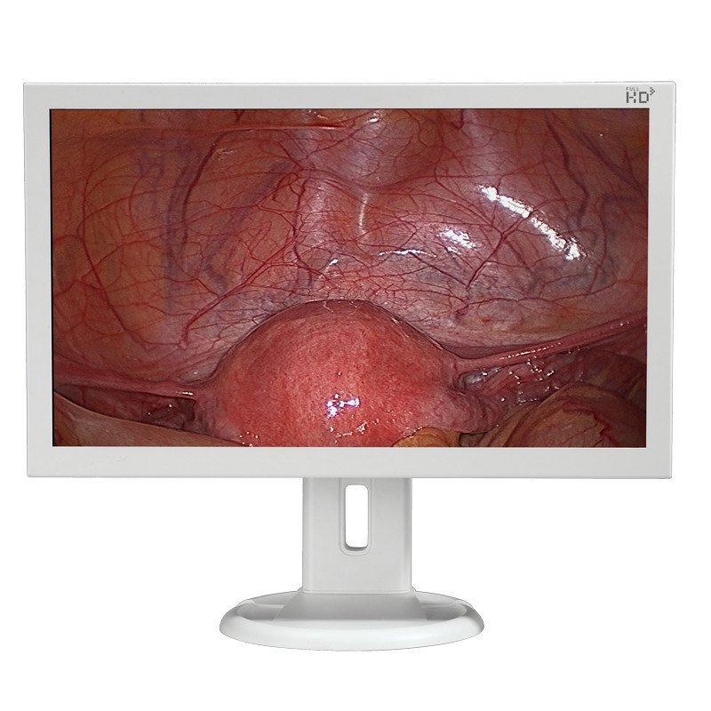 HD 21.5&quot; Endoscopy Surgical Monitor