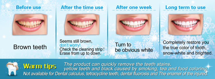 lifenano-teeth-cleaning-kit-quick-remove-the-teeth-stains.jpg kit de nettoyage lifenano-dents-rapide-enlever-les-dents-dents.jpg