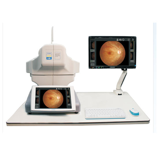 RET-3100 الصين أعلى جودة معدات طب العيون التصوير الفوتوغرافي كاميرا قاع العين