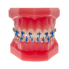 Liberty Glossy 2G Self-ligating Brackets