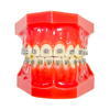 Liberty Glossy 1G Self-ligating Brackets