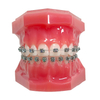Liberty 2G Self-ligating Brackets