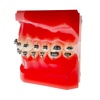 Interactive Self-ligating Buccal Tubes