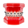 Liberty 2G Interactive Self-ligating Brackets
