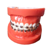 Liberty 1G Self-ligating Brackets