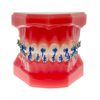 Liberty3G Self-ligating Brackets