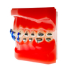 Self-ligating Buccal Tubes