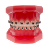 Liberty 1G Interactive Self-ligating Brackets