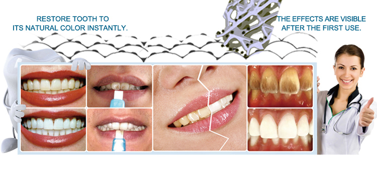 white teeth stains Cleaning kit tooth remover white teeth stains Cleaning kit tooth remover