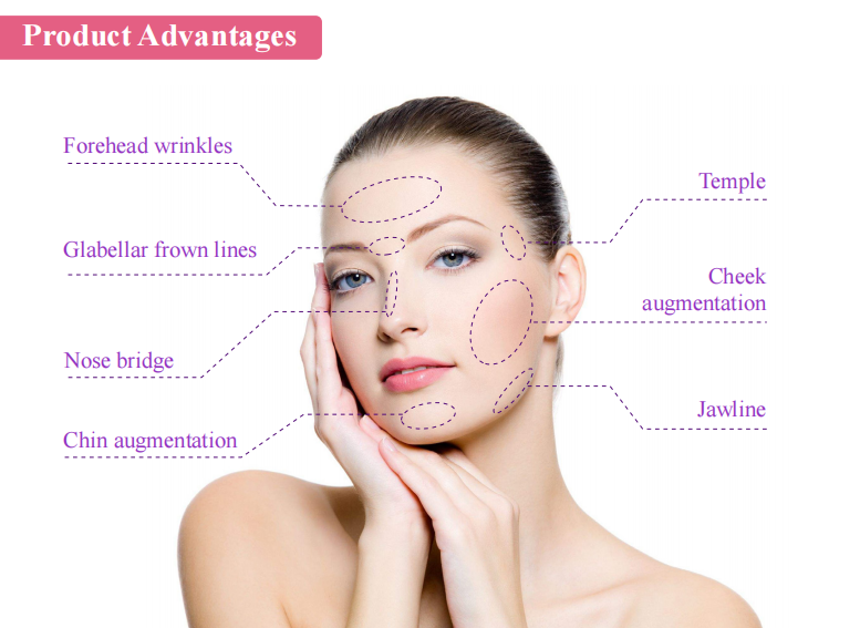Dermal Doldurucu Enjeksiyonları