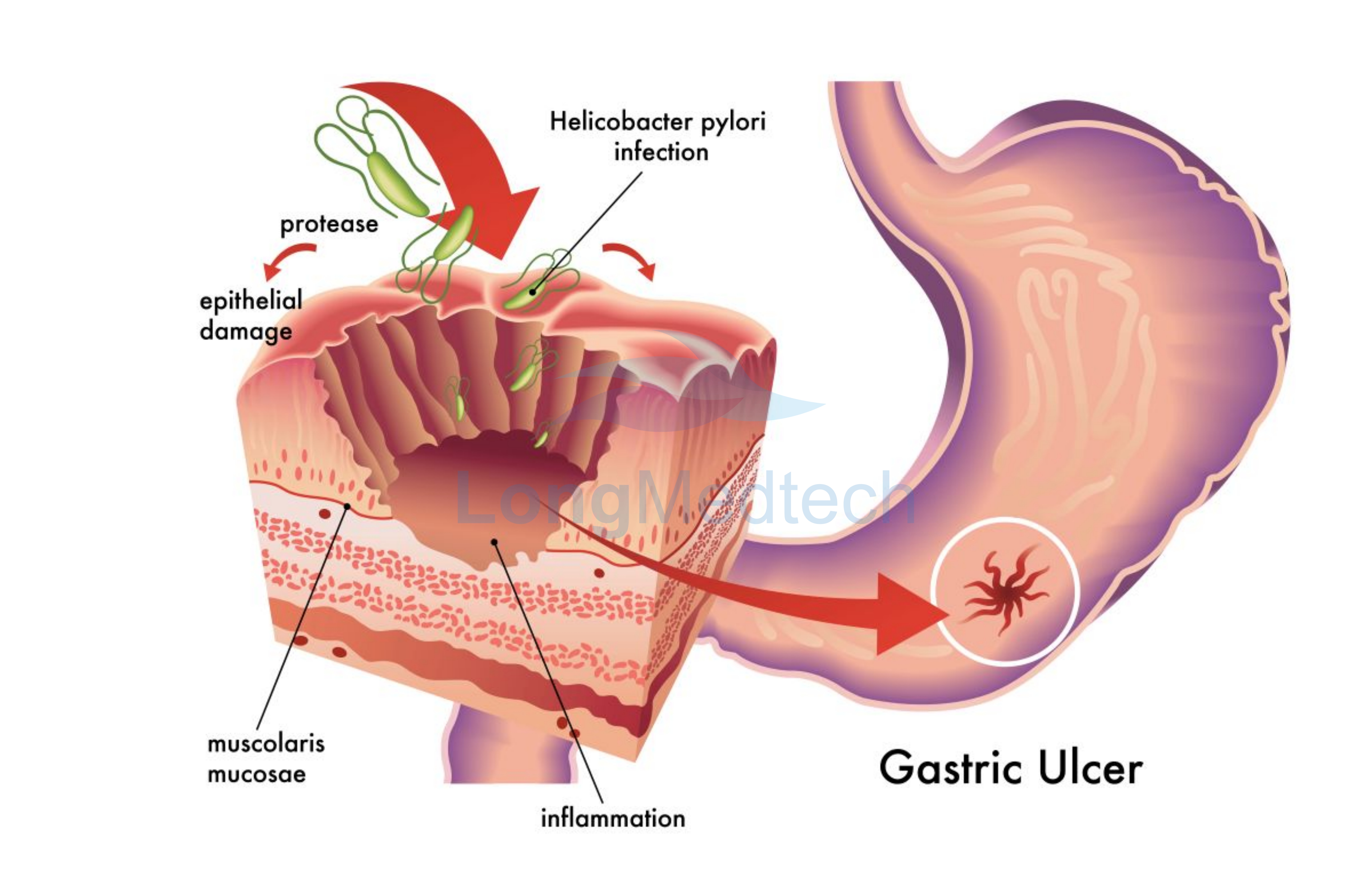 تكاثر الـ H-Pylori