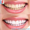 Kit De Limpieza De Dientes LF003