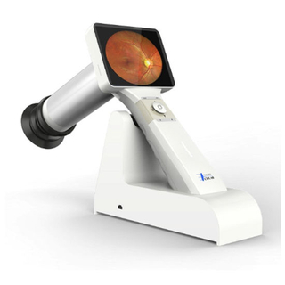 Hfc-600 Ophthalmic Equipment Handheld Fundus Camera