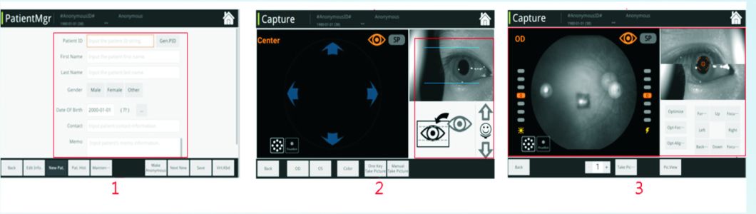 Reticam 3100 Cámara retinal oftálmica de alta calidad con equipamiento de China