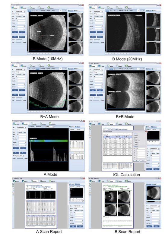 Matériel ophtalmique Ab Scan ophtalmique,