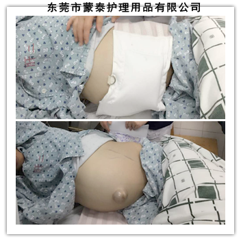 Compression belly-band clinical use