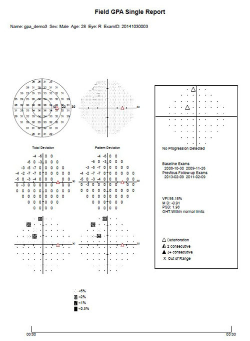 Périmètre automatique d'équipement ophtalmique de qualité supérieure de la Chine (APS-T00)