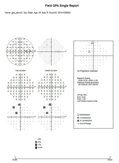 Analyseur de champ visuel Humphrey de matériel ophtalmique de vente chaude d'Aps-T00 Chine