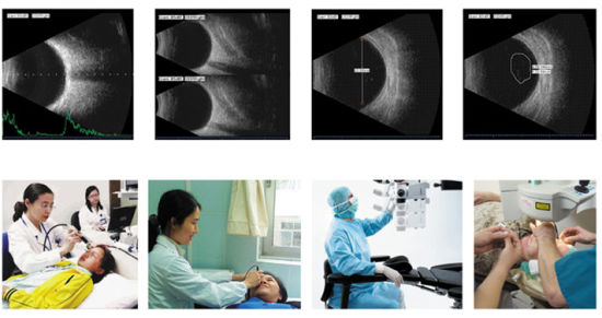 Equipo oftálmico, exploración oftalmológica del ab de China