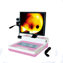 Jy-2520 Infrared Galactophore Diagnosis Instrument