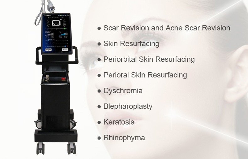 Hochleistungs -Pigmco2 Fractional Laser Machine