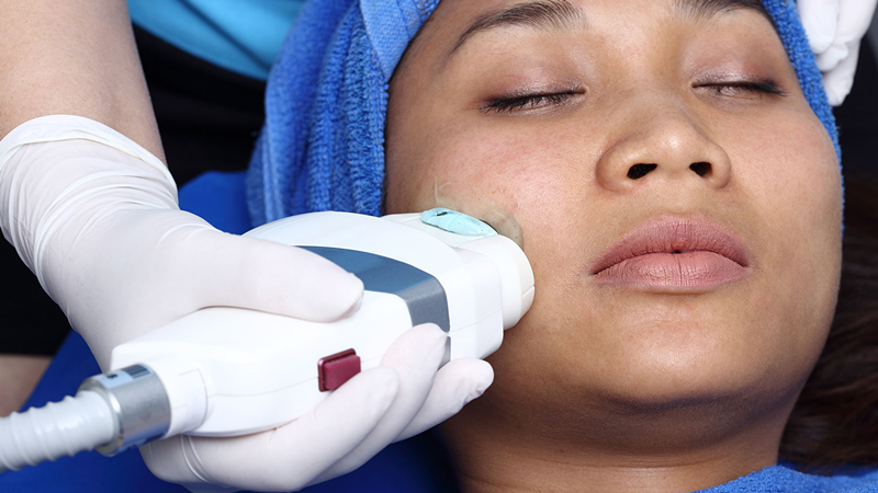 635A {8YJ7X99Y1SR1Q`] 1G2