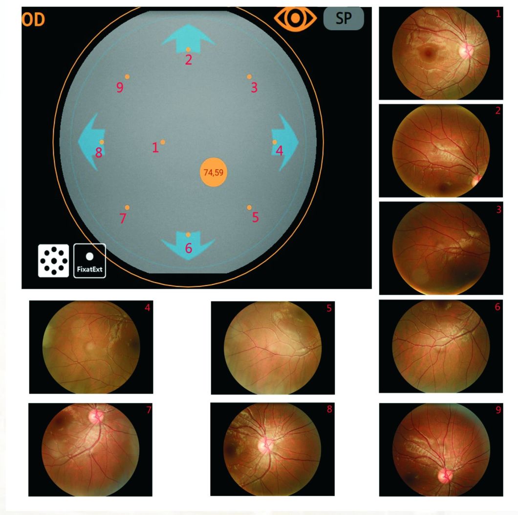 Reticam 3100 Cámara retinal oftálmica de alta calidad con equipamiento de China