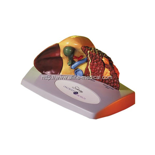 Liver pathology model