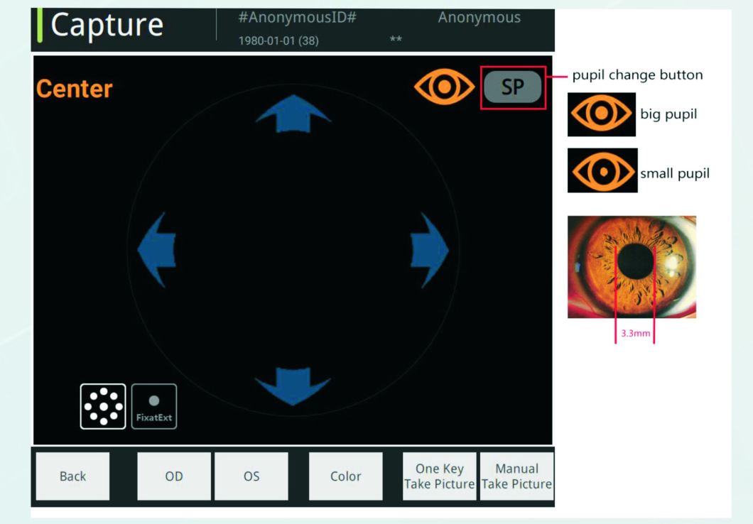 Appareil photo rétinien ophtalmique de qualité supérieure Reticam 3100 Chine