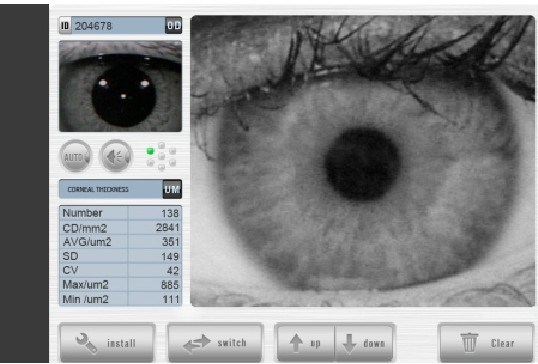 Compteur de cellules endothéliales cornéennes He-7000 China Ophthalmic Equipment