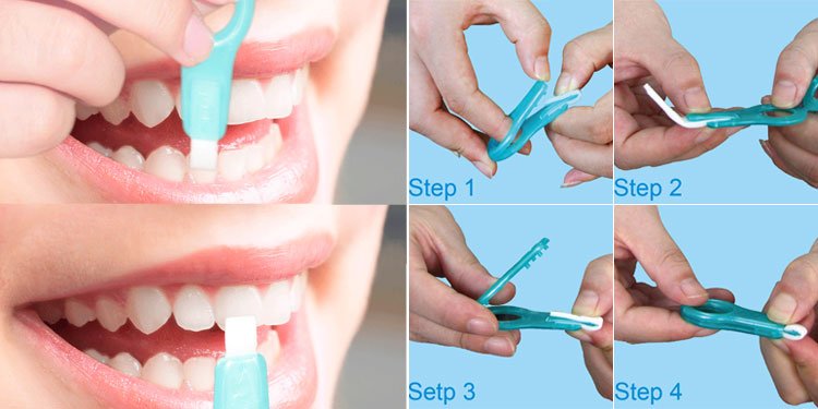 utiliser-les-dents-nettoyage-kit-effacer-les-dents-taches-par-le-front-side-et-s'il vous pla&icirc;t-soyez-un-litlle-gentle.jpg