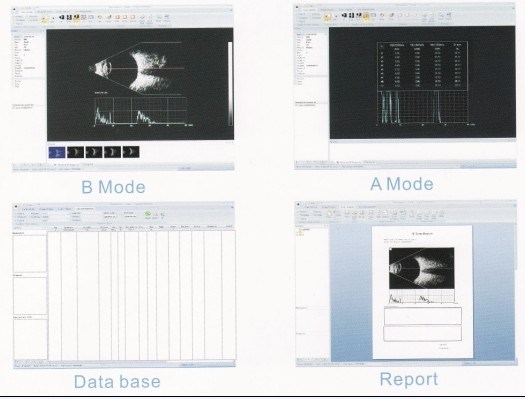 Scanner a / B phtalmique de qualité supérieure en Chine