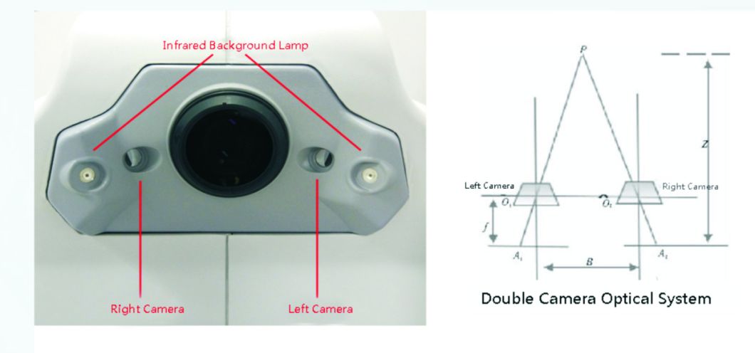Reticam 3100 Cámara retinal oftálmica de alta calidad con equipamiento de China