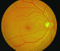 China Top Quality Ophthalmic Equipment Retinal Camera China