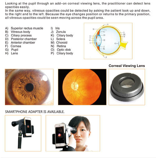 Ophtalmoscope numérique d'équipement Cjy-800 Chine