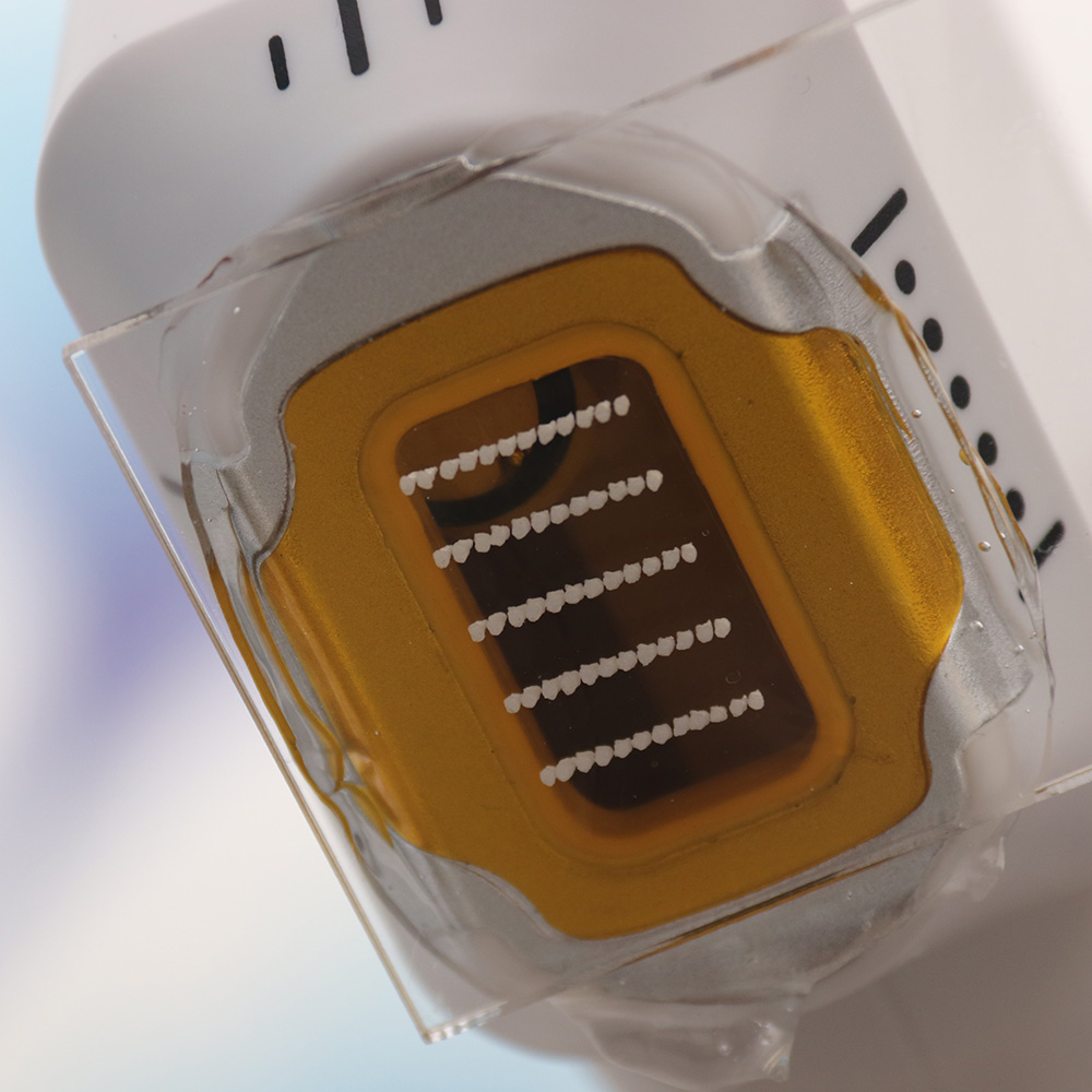 2 in 1 gefrorenem Eis Vmax Hifu Ultraschallmaschinen Anti-Aging-Falten-Narben-Sommersprossenentfernung