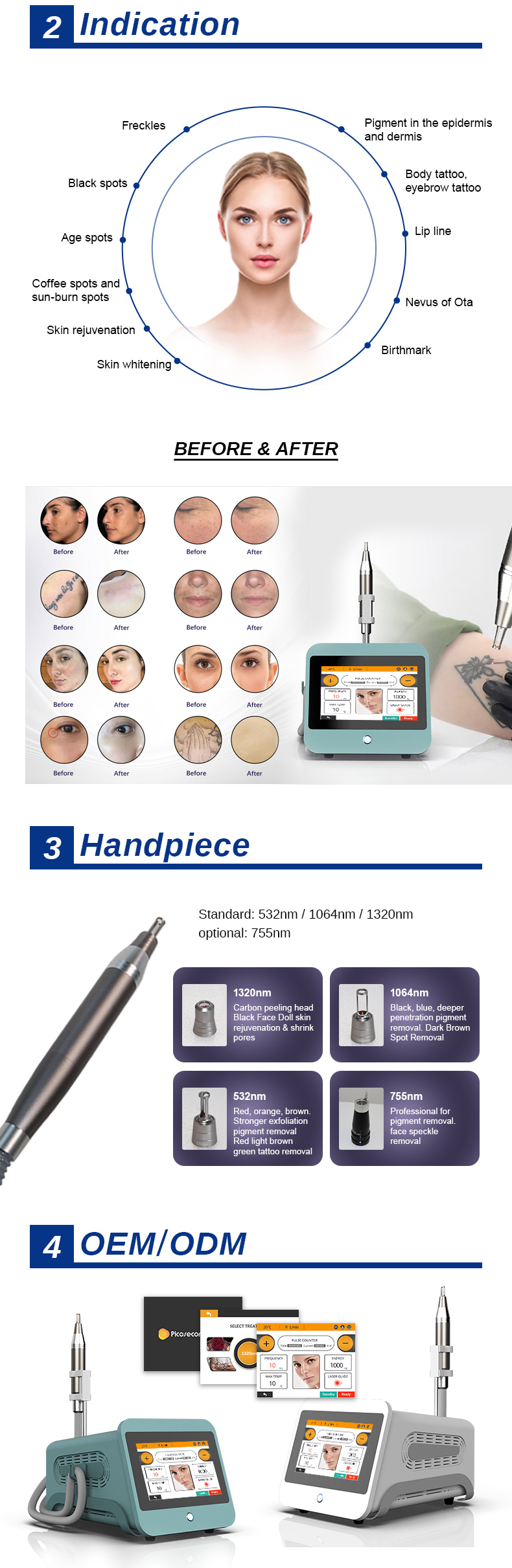 Tattoo -Entfernungsmaschine