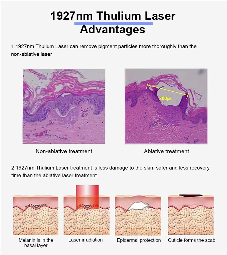 Thulium -Laser