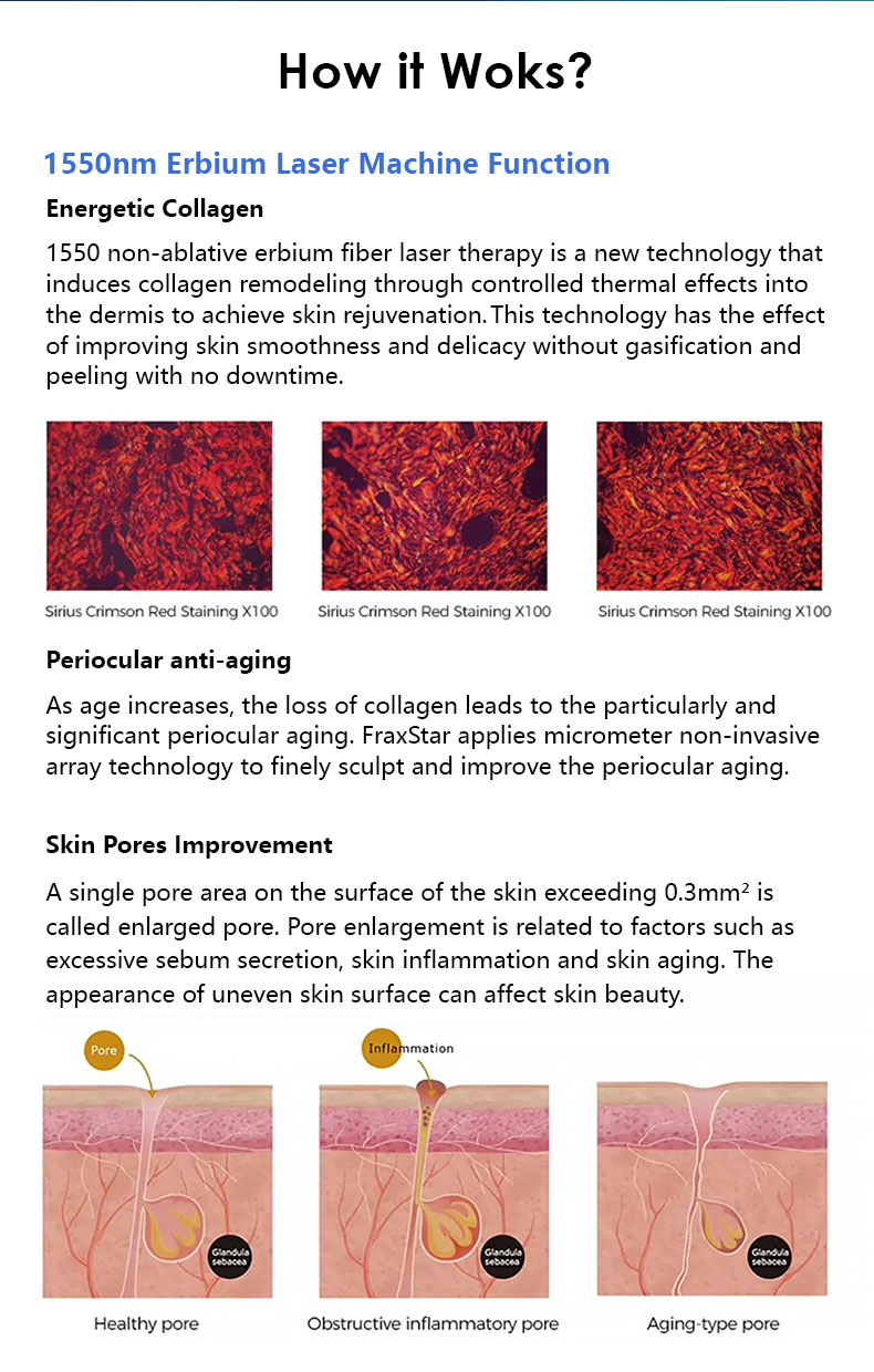 Машина для омоложения кожи