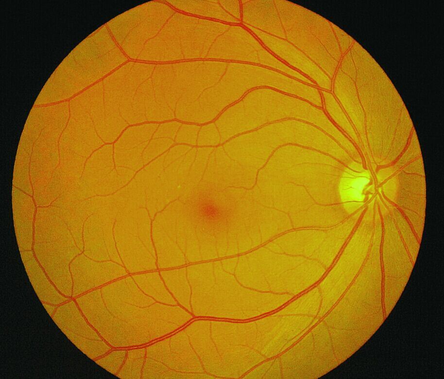 Aps-una cámara retinal del equipo oftálmico de calidad superior de China
