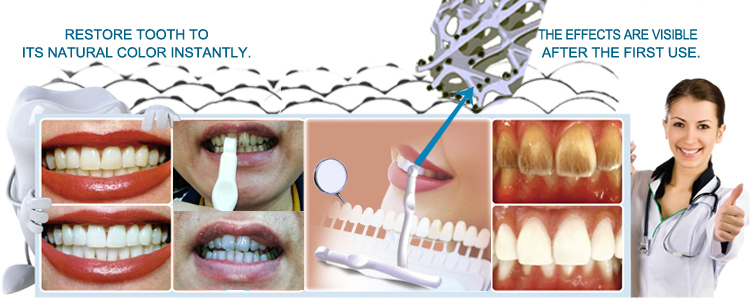 dirty teeth cleaning TEETH ERASER