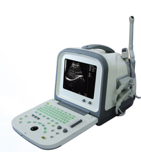 B-Ultrasound Scanner Machine (Model HY5511)